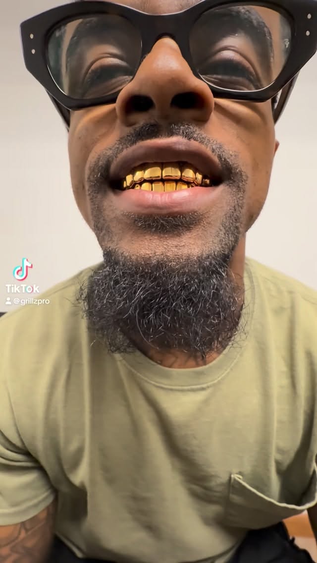 ‼️NPG SALE‼️(Available in Yellow & Rose Color)Signature Deepcut Florida Grillz Unbeatable Quality NPG/DENTAL GOLD SALE 6 on 6 $299+Tax8 on 8 $399+Tax10 on 10 $499+Tax12 on 12 $599+TaxOrders your BEST DEEPCUTS/PERMCUTS GRILLZ todayCall text 813-525-5539 Or DMOrder online www.grillzpro.comWalk-in are welcome At4912 Southfork dr lakeland 863-606-2212#lakelandfl #grillzpro #grillz #npg by @grillzpro