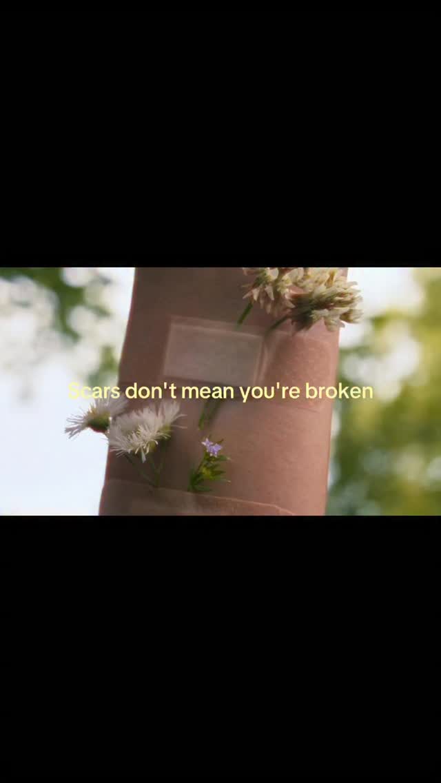 Your scars do not mean you are broken, they are instead a sign of your healing. We all go through such darkness in life and it threatens to break us. When we survive these things we come out with scars where the darkness didn't win. We keep going. We are continually healing. ❤️#hope #hopecore #healing #selfworth by @cimorelliband