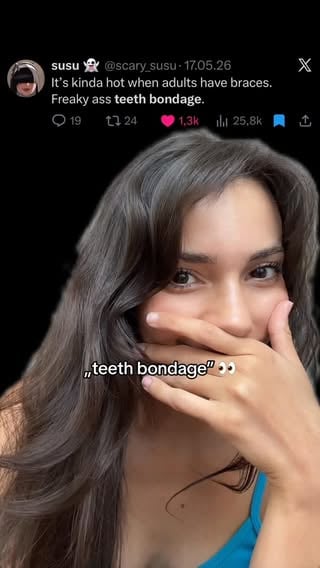 Actually- #teeth #braces by @sara02wolf