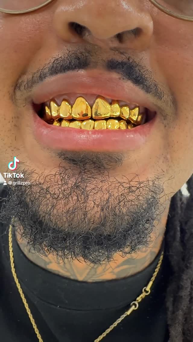 ‼️NPG SALE‼️(Available in Yellow & Rose Color)Signature Deepcut Florida Grillz Unbeatable Quality NPG/DENTAL GOLD SALE 6 on 6 $299+Tax8 on 8 $399+Tax10 on 10 $499+Tax12 on 12 $599+TaxOrders your BEST DEEPCUTS/PERMCUTS GRILLZ todayCall text 813-525-5539 Or DMOrder online www.grillzpro.comWalk-in are welcome At4912 Southfork dr lakeland 863-606-2212#lakelandfl #grillzpro #grillz #npg by @grillzpro