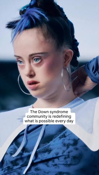 The Down syndrome community is redefining what’s possible every day. Dreams are bigger, opportunities are growing, and the future has never looked brighter. ✨💛💙
.
.
.
.
.
.
.
.
.
#downsyndrome #downsyndromeawareness #youareworthy #youareenough
